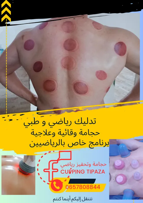 الحجامة و التحفيز الرياضي cupping tipaza خبرة 13 سنة في المي