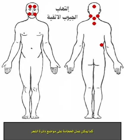 حياكم الله جميعا اخواني الكرام ..أخوكم معالج في الطب الأصيل 