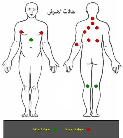 حياكم الله جميعا اخواني الكرام ..أخوكم معالج في الطب الأصيل 