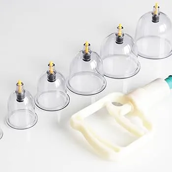 الحجامة hijama