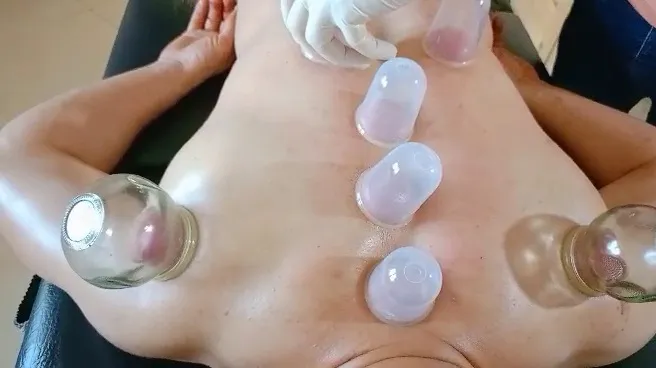 الحجامة و التحفيز الرياضي cupping tipaza خبرة 13 سنة في المي