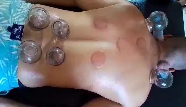 الحجامة و التحفيز الرياضي cupping tipaza خبرة 13 سنة في المي