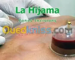 medecin  fait l' hijama a domicil
اللهم صلي على محمد. و على 