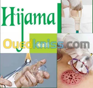 medecin  fait l' hijama a domicil
اللهم صلي على محمد. و على 