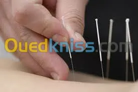 Medecine Esthétique et Accupuncture 
*Dr . w.Djerad 
*Diplo