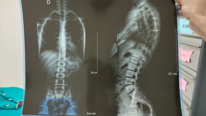 Kinésitherapeute a domicile 
حجامة . ماساج ...