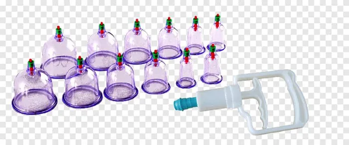 الحجامة hijama